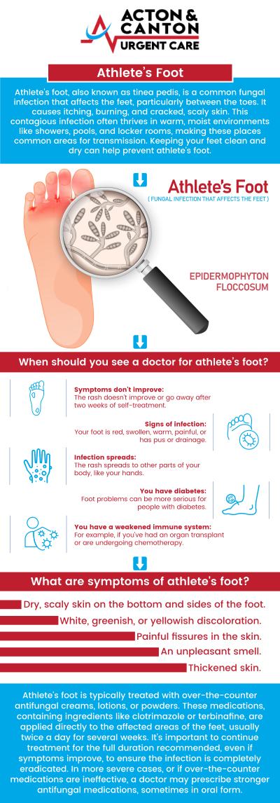 Common questions asked by patients: Should you go to urgent care for athlete's foot? Can urgent care treat fungal infections? Can you go to urgent care for a foot infection? How to treat athlete's foot on toddler? For more information, contact us or schedule an appointment online. We are located at 95 Washington St, Ste 204 A, Canton, MA 02021. We serve patients from Canton MA, Sharon MA, Stoughton MA, Norwood MA, Walpole MA, Westwood MA, Milton MA, Raynham MA, and surrounding areas. Common questions asked by patients: Should you go to urgent care for athlete's foot? Can urgent care treat fungal infections? Can you go to urgent care for a foot infection? How to treat athlete's foot on toddler? For more information, contact us or schedule an appointment online. We are located at 95 Washington St, Ste 204 A, Canton, MA 02021. We serve patients from Canton MA, Sharon MA, Stoughton MA, Norwood MA, Walpole MA, Westwood MA, Milton MA, Raynham MA, and surrounding areas.