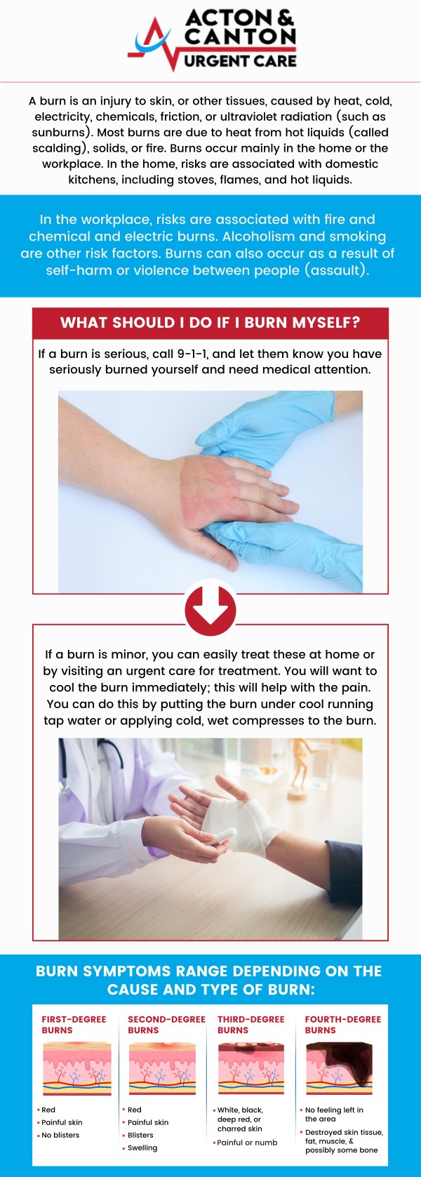 Common questions asked by patients: What are the different types and degrees of burns? When should I seek medical attention for a burn? How can I tell if a burn is serious or can be treated at home? What are the common symptoms of minor and severe burns? For more information, contact us or schedule an appointment online. We are located at 95 Washington St, Ste 204 A, Canton, MA 02021. We serve patients from Canton MA, Sharon MA, Stoughton MA, Norwood MA, Walpole MA, Westwood MA, Milton MA, Raynham MA, and surrounding areas. Common questions asked by patients: What are the different types and degrees of burns? When should I seek medical attention for a burn? How can I tell if a burn is serious or can be treated at home? What are the common symptoms of minor and severe burns? For more information, contact us or schedule an appointment online. We are located at 95 Washington St, Ste 204 A, Canton, MA 02021. We serve patients from Canton MA, Sharon MA, Stoughton MA, Norwood MA, Walpole MA, Westwood MA, Milton MA, Raynham MA, and surrounding areas.