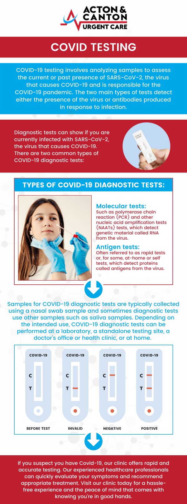 Common questions asked by patients: What are the most common symptoms of COVID-19? How does COVID-19 spread from person to person? When should I get tested for COVID-19? What should I do if I test positive for COVID-19? For more information, contact us or schedule an appointment online. We are located at 100 Powder Mill Rd, Acton, MA 01720. We serve patients from Acton MA, Maynard MA, Stow MA, Concord MA, Sudbury MA, Boxborough MA, and surrounding areas.