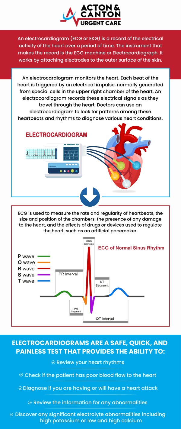 Common questions asked by patients: What is an EKG test and why is it done at urgent care? When should I visit urgent care for an EKG instead of the emergency room? How does an EKG help diagnose heart-related conditions? What symptoms indicate I might need an EKG test? For more information, contact us or schedule an appointment online. We are located at 100 Powder Mill Rd, Acton, MA 01720. We serve patients from Acton MA, Maynard MA, Stow MA, Concord MA, Sudbury MA, Boxborough MA, and surrounding areas. Common questions asked by patients: What is an EKG test and why is it done at urgent care? When should I visit urgent care for an EKG instead of the emergency room? How does an EKG help diagnose heart-related conditions? What symptoms indicate I might need an EKG test? For more information, contact us or schedule an appointment online. We are located at 100 Powder Mill Rd, Acton, MA 01720. We serve patients from Acton MA, Maynard MA, Stow MA, Concord MA, Sudbury MA, Boxborough MA, and surrounding areas.