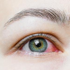 Eye Infection Treatment Near Me in Canton and Acton, MA