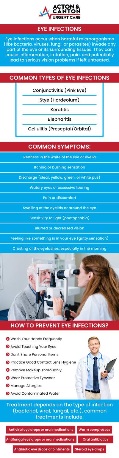 Eye infections can lead to painful symptoms and, if left untreated, may cause more serious complications. At Acton and Canton Urgent Care, our professional team offers fast and effective treatment for conditions such as pink eye, styes, and conjunctivitis. Muhammad Bajwa, MD, provides comprehensive care to address your symptoms and help you recover quickly, ensuring your eye health is restored. For more information, contact us or schedule an appointment online. We Are Located at 100 Powder Mill Rd, Acton, MA 01720. Eye infections can lead to painful symptoms and, if left untreated, may cause more serious complications. At Acton and Canton Urgent Care, our professional team offers fast and effective treatment for conditions such as pink eye, styes, and conjunctivitis. Muhammad Bajwa, MD, provides comprehensive care to address your symptoms and help you recover quickly, ensuring your eye health is restored. For more information, contact us or schedule an appointment online. We Are Located at 100 Powder Mill Rd, Acton, MA 01720.