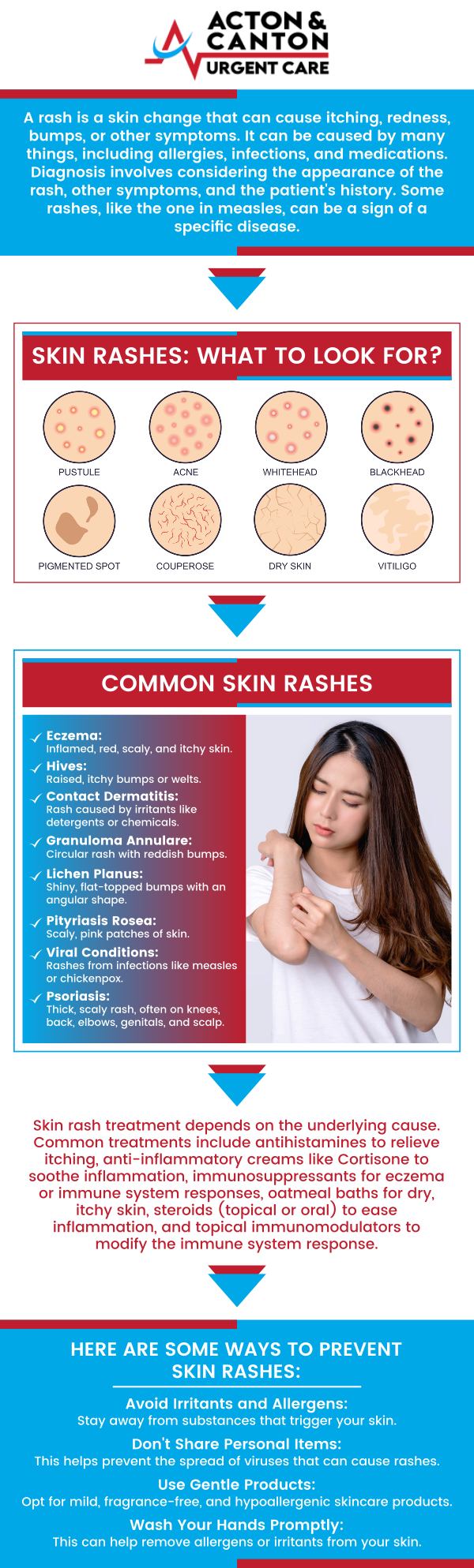 At Canton Urgent Care in Canton, MA, Muhammad Bajwa, MD, provides evaluation and treatment for various skin rashes caused by allergies, infections, or irritants. Common symptoms include redness, itching, swelling, or small bumps on the skin. Dr. Bajwa ensures accurate diagnosis and effective relief to restore skin comfort. For more information, contact us or schedule an appointment online. We are located at 95 Washington St, Ste 204 A, Canton, MA 02021.  At Canton Urgent Care in Canton, MA, Muhammad Bajwa, MD, provides evaluation and treatment for various skin rashes caused by allergies, infections, or irritants. Common symptoms include redness, itching, swelling, or small bumps on the skin. Dr. Bajwa ensures accurate diagnosis and effective relief to restore skin comfort. For more information, contact us or schedule an appointment online. We are located at 95 Washington St, Ste 204 A, Canton, MA 02021.