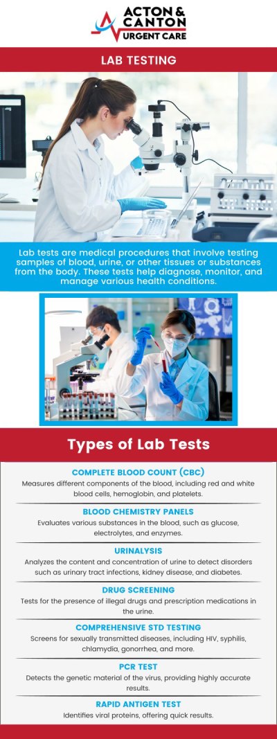 Lab testing is a crucial diagnostic tool that helps identify underlying health conditions and monitor overall well-being. Our clinic offers a wide range of accurate and reliable tests to help detect infections, manage chronic conditions, and guide treatment plans. Visit our experienced team at Acton Urgent Care today for professional lab testing with fast, confidential results. For more information, contact us or schedule an appointment online. We are located at 100 Powder Mill Rd, Acton, MA 01720. 