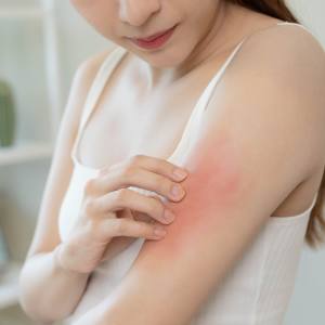 Rashes Treatment Near Me in Canton and Acton, MA