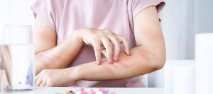 Skin Infections Treatment Clinic Near Me in Acton, MA Skin Infections Treatment Clinic Near Me in Acton, MA