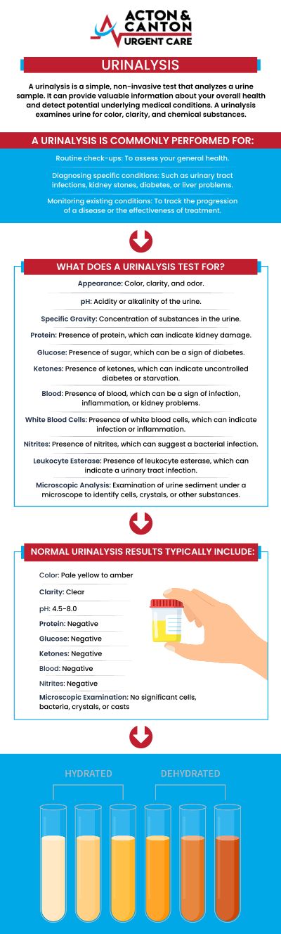 Common questions asked by patients: What is a urinalysis, and why is it performed? What can a urinalysis detect in terms of health issues? How should I prepare for a urinalysis test? What are the different types of urinalysis tests? For more information, contact us or schedule an appointment online. We are located at 100 Powder Mill Rd, Acton, MA 01720. We serve patients from Acton MA, Maynard MA, Stow MA, Concord MA, Sudbury MA, Boxborough MA, and surrounding areas.
