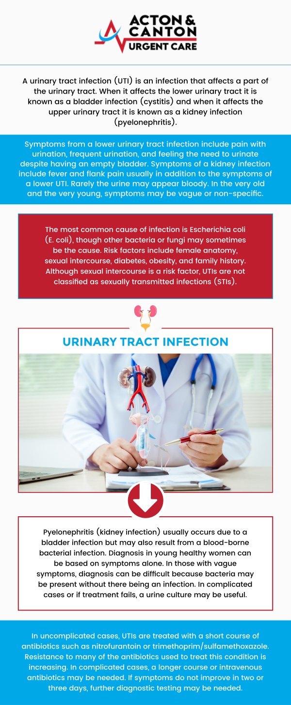 If you are experiencing the painful symptoms of a Urinary Tract Infection (UTI), Canton Urgent Care offers fast, confidential, and effective walk-in care right here in Canton, MA. Our clinic is equipped with an on-site lab to perform immediate urinalysis, providing a rapid diagnosis and allowing our providers to prescribe the necessary antibiotics or medications needed for quick relief. For more information, contact us or schedule an appointment online. We are located at 95 Washington St, Ste 204 A, Canton, MA 02021.  If you are experiencing the painful symptoms of a Urinary Tract Infection (UTI), Canton Urgent Care offers fast, confidential, and effective walk-in care right here in Canton, MA. Our clinic is equipped with an on-site lab to perform immediate urinalysis, providing a rapid diagnosis and allowing our providers to prescribe the necessary antibiotics or medications needed for quick relief. For more information, contact us or schedule an appointment online. We are located at 95 Washington St, Ste 204 A, Canton, MA 02021.