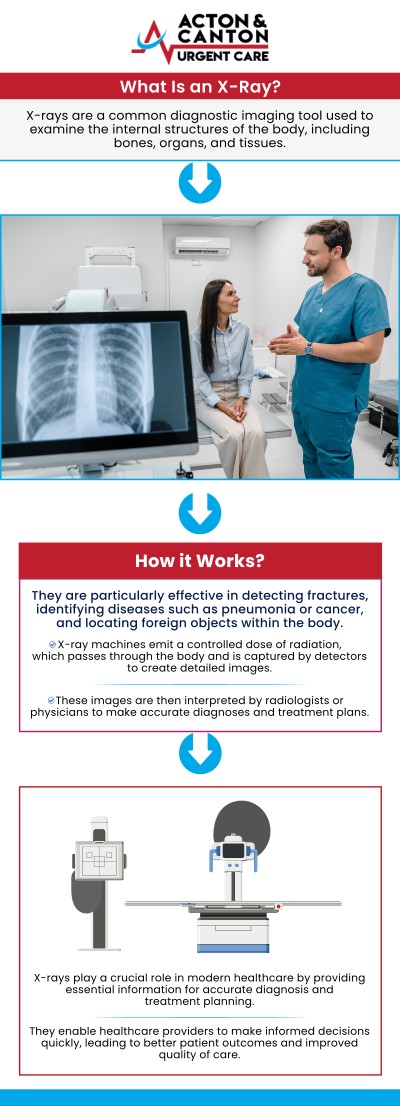 At Acton and Canton Urgent Care, we provide comprehensive urgent care services, including on-site X-ray capabilities for accurate diagnosis and immediate treatment. Whether you're suffering from a sprain, strain, or suspected fracture, visit Muhammad Bajwa, MD, for fast and accurate care. For more information, contact us or schedule an appointment online. We are located at 95 Washington St, Ste 204 A, Canton, MA 02021. At Acton and Canton Urgent Care, we provide comprehensive urgent care services, including on-site X-ray capabilities for accurate diagnosis and immediate treatment. Whether you're suffering from a sprain, strain, or suspected fracture, visit Muhammad Bajwa, MD, for fast and accurate care. For more information, contact us or schedule an appointment online. We are located at 95 Washington St, Ste 204 A, Canton, MA 02021.