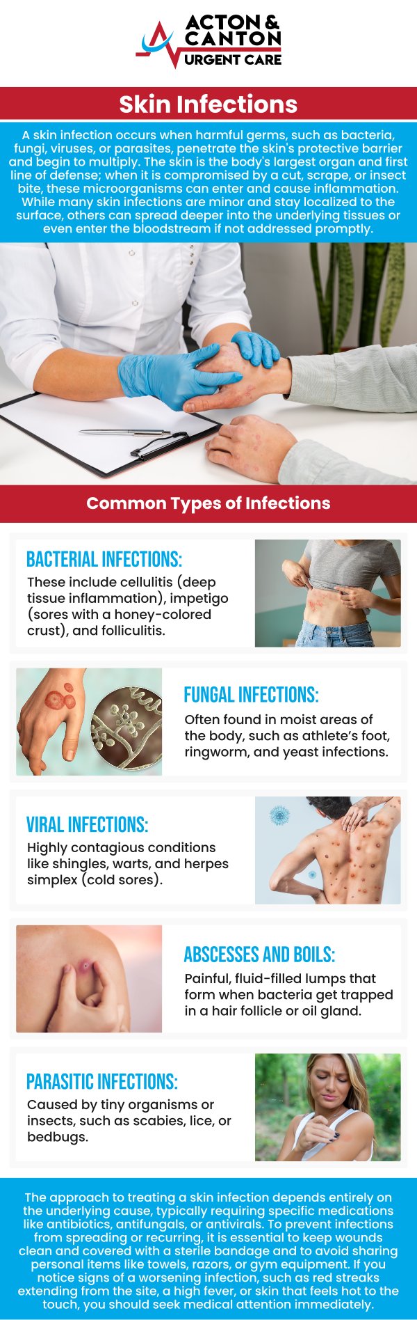Common questions asked by patients: What are the most common types of skin infections? What causes skin infections to develop? How can I tell if a skin infection is bacterial, fungal, or viral? What are the typical symptoms of a skin infection? For more information, contact us or schedule an appointment online. We are located at 100 Powder Mill Rd, Acton, MA 01720. We serve patients from Acton MA, Maynard MA, Stow MA, Concord MA, Sudbury MA, Boxborough MA, and surrounding areas.