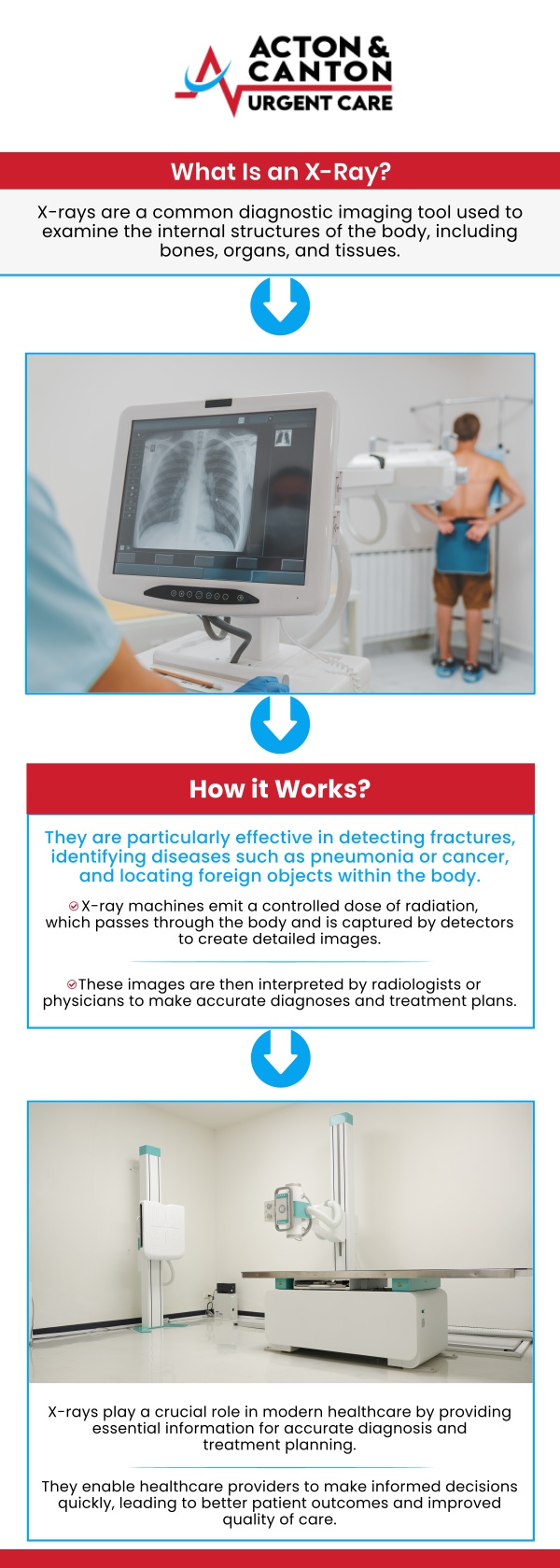 When it comes to persistent joint pain or suspected fractures, visibility is the first step toward recovery. For residents in Canton, MA, X-rays serve as an indispensable diagnostic tool that bridges the gap between a physical exam and an effective treatment plan. Our team of dedicated healthcare professionals utilizes advanced imaging technology to capture detailed views of internal structures, allowing us to pinpoint hairline fractures, joint dislocations, and degenerative conditions like osteoarthritis with unmatched clarity. For more information, contact us or schedule an appointment online. We are located at 95 Washington St, Ste 204 A, Canton, MA 02021.